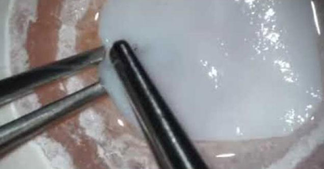 Surgeon Shows Off His Skills by Sewing Egg Back Together