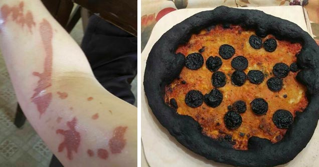 a person burned from cooking and a totally burnt pizza