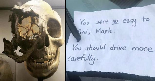 a skull with bone cancer and a creepy note