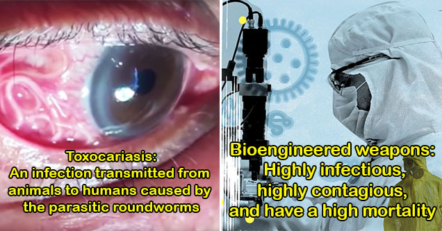 the scariest things in the world -  roundworms in an eye -  bio weapons