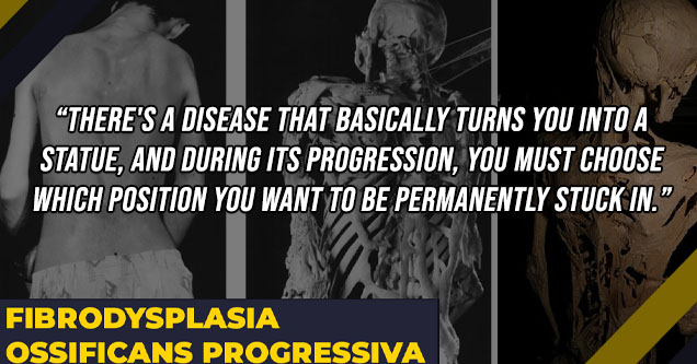 bone disease - There's a disease that basically turns you into a statue, and during its progression, you must choose which position you want to be permanently stuck in. - NeedsMoreTuba