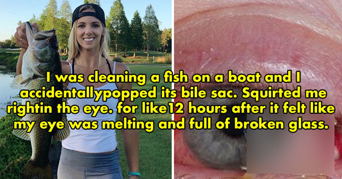 painful experiences - woman who got fish bile in her eye