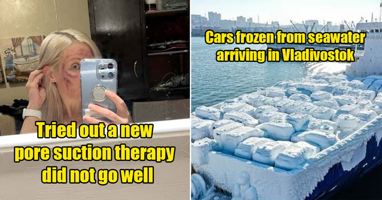 frozen cars on a ship -  suction cup therapy on face