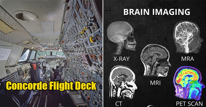 cool pics -  brain scans -  X-ray, MRI - Concorde flight deck