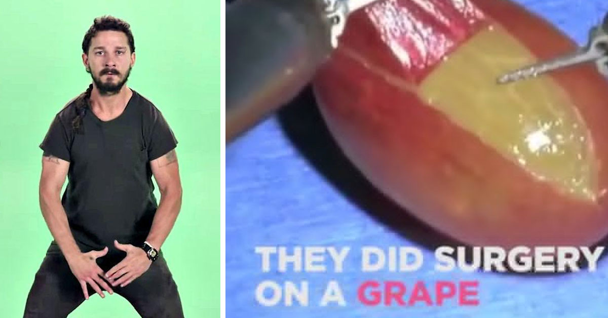 surgery on a grape and shia lebeouf