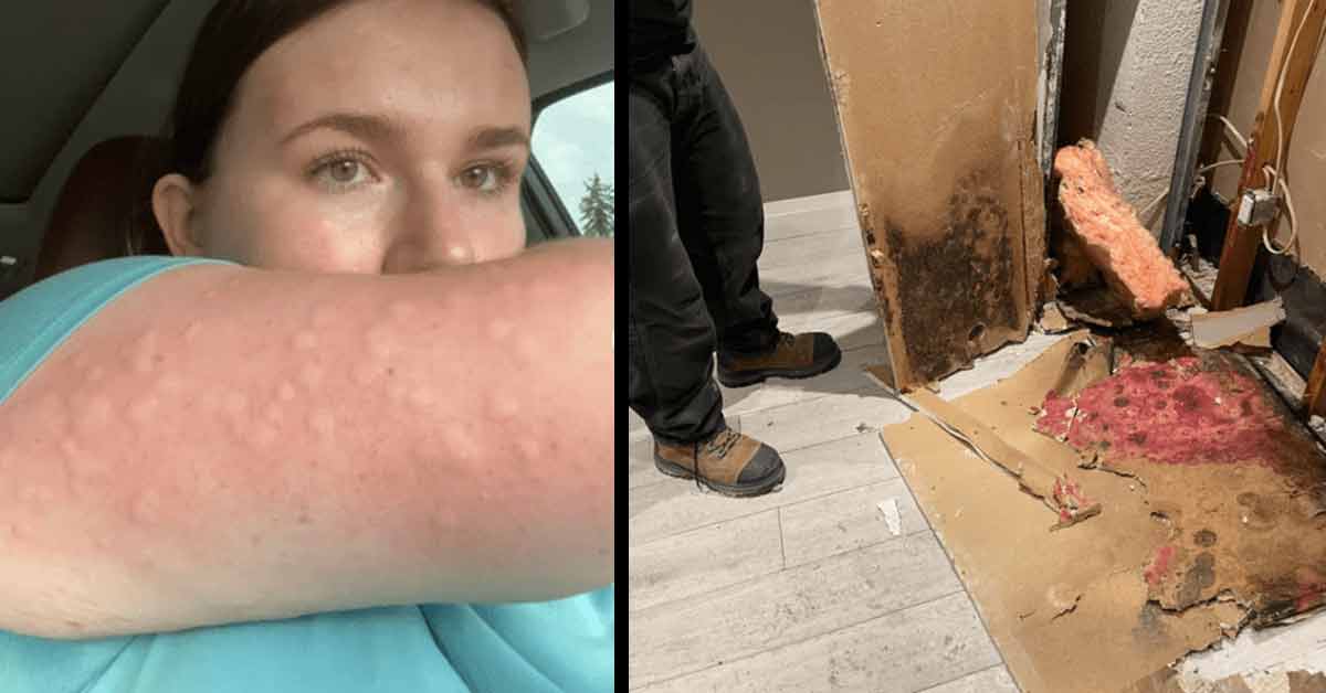 woman eaten up by bugs and mold in house