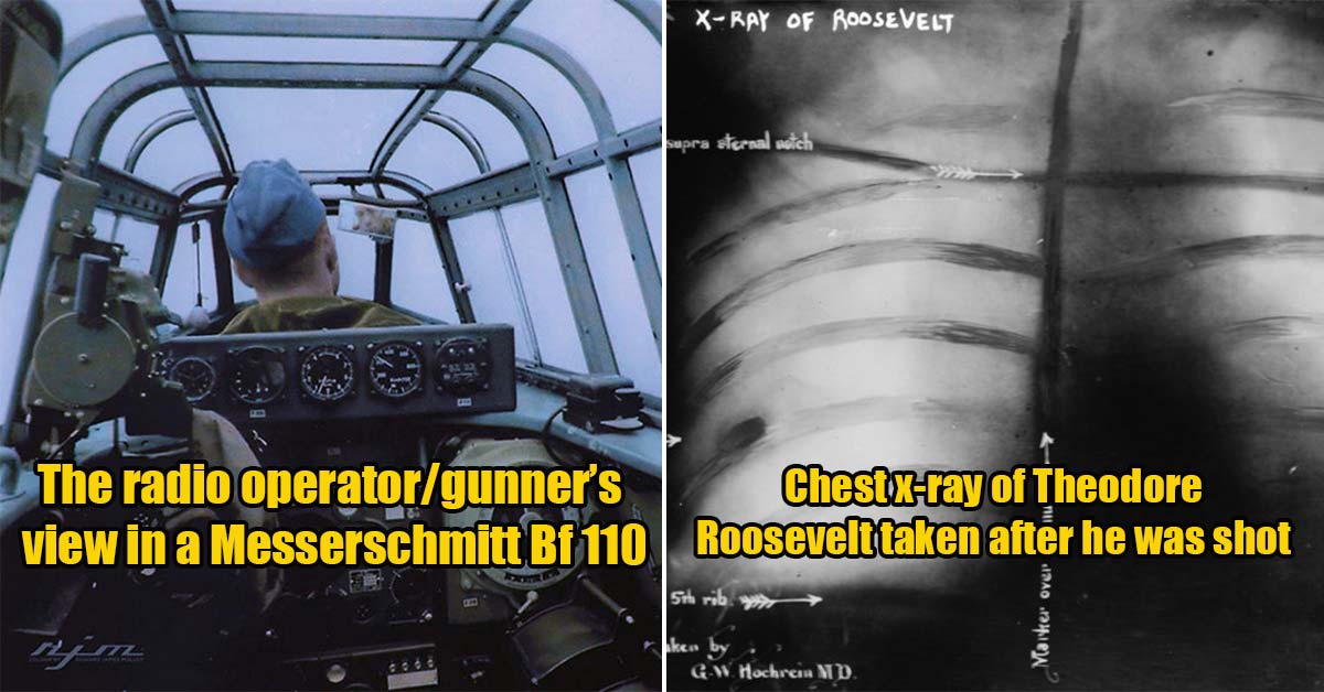 chest x-ray of theodore Roosevelt chest after he was shot - view from a plane cockpit