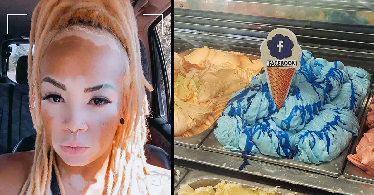 fascinating photos a woman with vitiligo and facebook ice cream