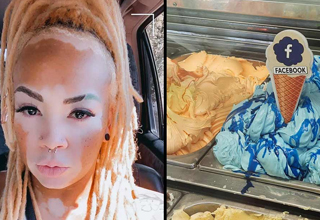 fascinating photos a woman with vitiligo and facebook ice cream