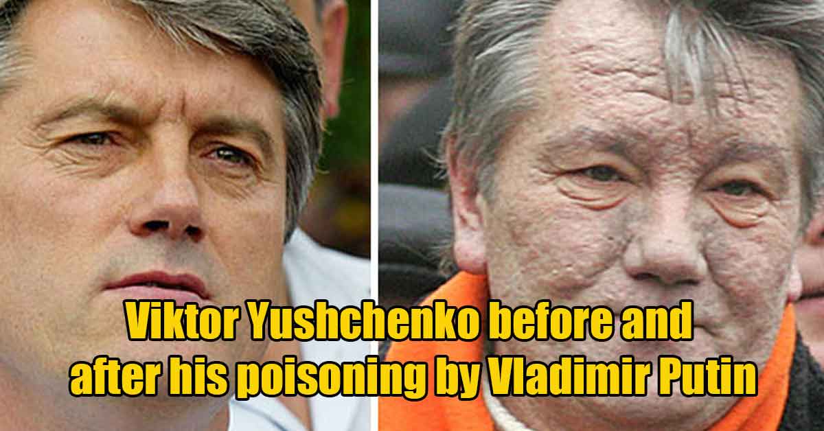 Viktor Yushchenko Before And After His Poisoning By Vladimir Putin