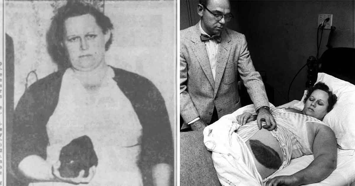 ann hodges, the woman who survived being hit with a meteorite