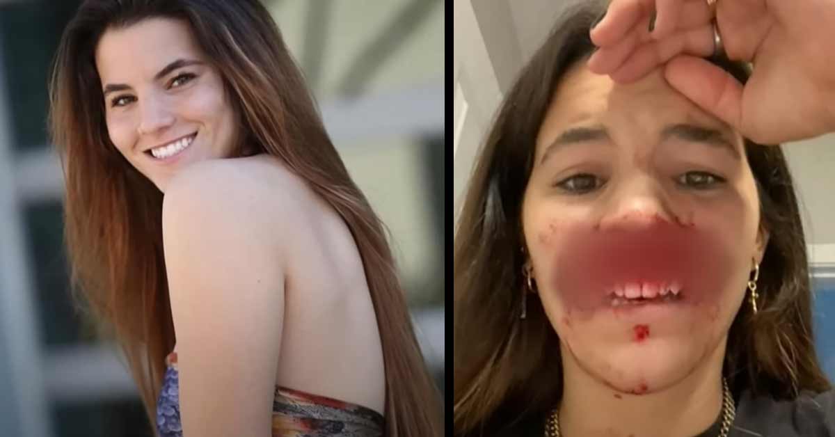 Life After Tragedy: The 22-Year-Old Model Who Survived a Pitbull Attack