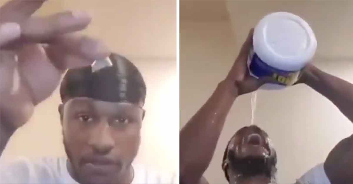 man pours bleach on his face