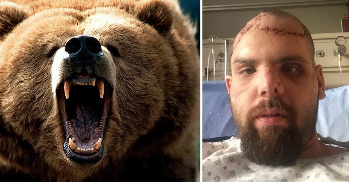 Grizzly Bear Attack Victim Tells His Horrific Story In Full Detail