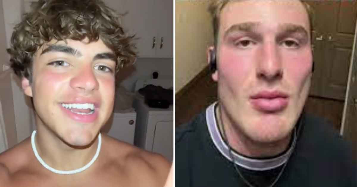 Incel Inspired ‘Looksmaxxing’ Is All the Rage With Gen Z Men