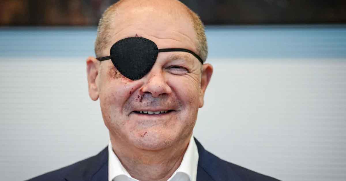 ‘Somebody Joined a Very Special Club’: Conspiracy Theorists Convinced German Chancellor Joined ‘Secret Fight Club’ After Flaunting Eye Patch, Scratched Face