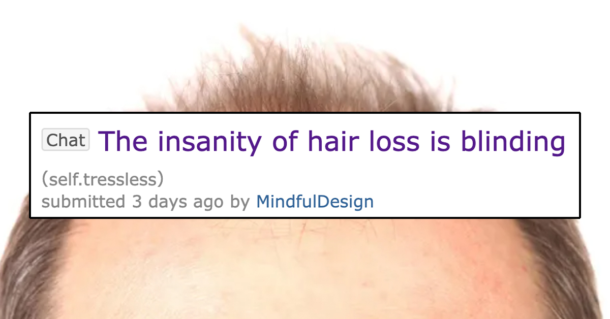 ‘Lucky Bastard’: Bald Redditor Jealous of Armless Man Because He Has Hair