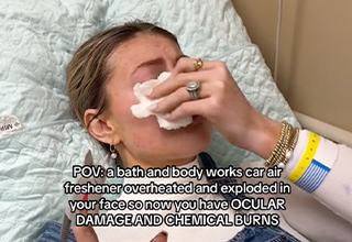 Woman Says She Was Left With Chemical Burns After Her Bath & Body Works Air Freshener Exploded