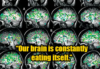 <p>It's bumpy. It's pinkish. It's full of electricity that makes us cry at bad commercials and laugh at our friends accidentally smacking themselves in the nuts. But even with these known oddities, the brain is a whole lot weirder than we initially realized — just ask the scientists tasked with researching it for themselves.&nbsp;</p><p><br></p><p>From our brain's insatiable hunger to whether (brain) size matters when it comes to the sexes, here are 20 spectacular facts about your brain.&nbsp;</p>