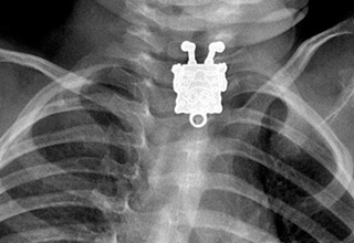 <p dir="ltr">People put crazy things in their bodies; Drugs, horrible food, other people, &nbsp;the list goes on and on. But if you really want to see how weird it can get, you need an X-ray technician. Since we don’t have many of those in our contact list, we thought we'd never get to see what kind of objects people dared to consume and insert.&nbsp;</p><p data-empty="true"><br></p><p dir="ltr">For now, we’re choosing to ignore the implied medical violations that come with these images being public. We just want to enjoy them. Get an inside look at what’s inside some people. Nails, beer bottles, guns, candy. Even Spongebob makes an appearance. The yellow sponge is so synonymous with culture, it lives inside our brains, and in some people, their stomachs.</p><p data-empty="true"><br></p><p dir="ltr">Check it out, enjoy it, and don’t clog yourself up like these folks did.&nbsp;</p>