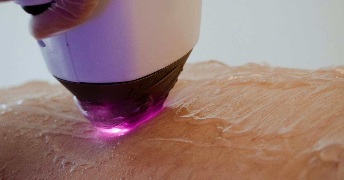 The U.S. Government Will Now Pay for Soldiers’ Laser Hair Removal
