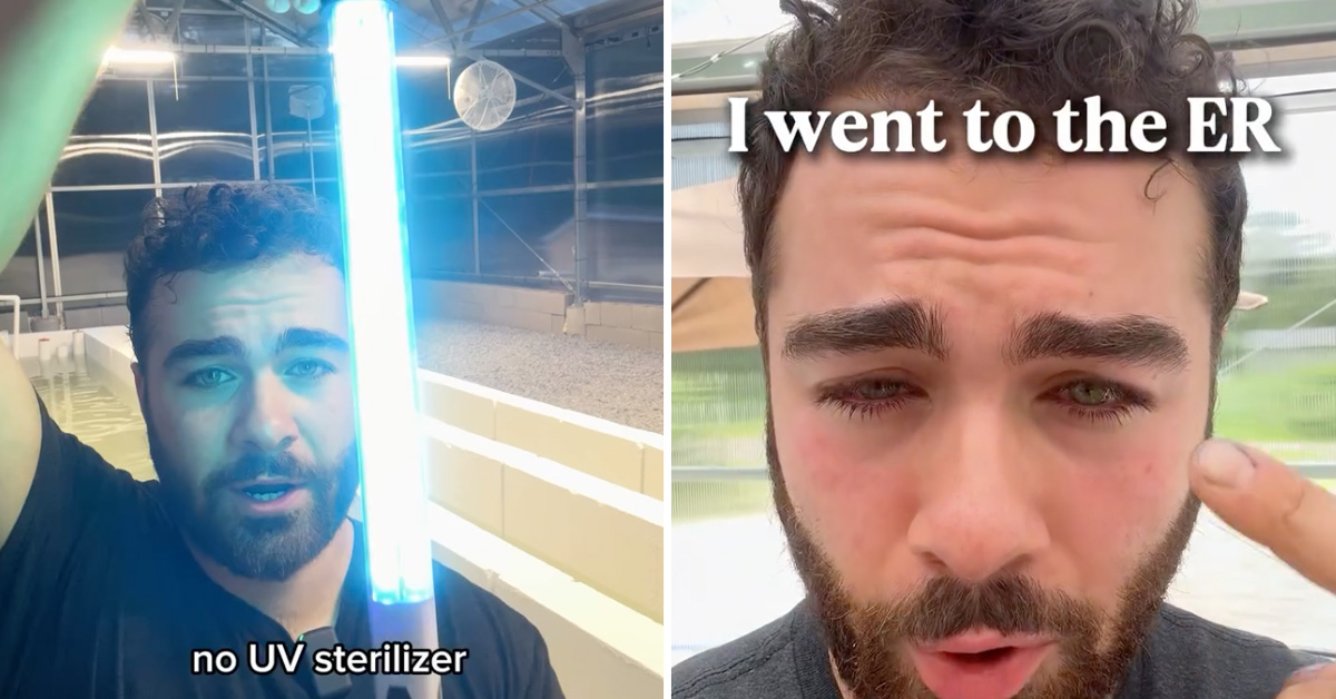 Man Reviews ‘UV Sterilizer,’ Accidentally Destroys His Eyes