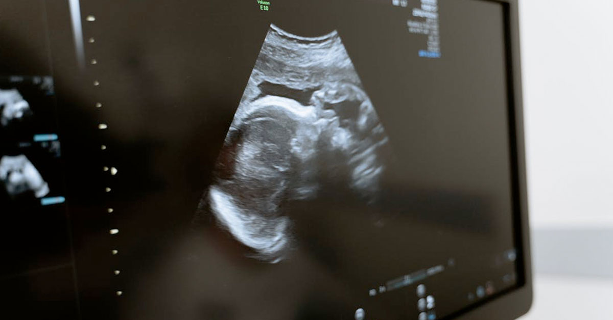 Women in Japan Are Selling Ultrasound Photos So People Can Blackmail Their Partners