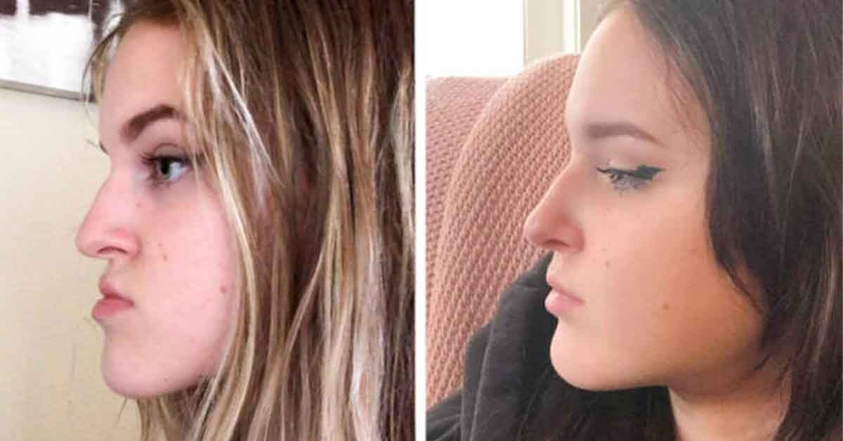 Before & After Photos of the World Changing Around Us