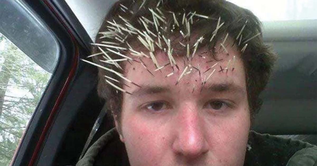 Unfortunate Moments For The World To See