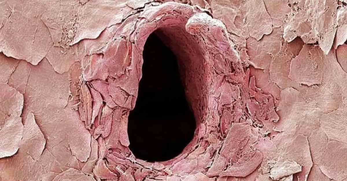 Unsettling Sights Revealed From Under the Microscope