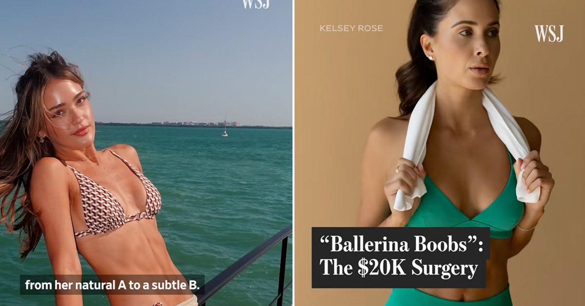 Ballerina Boobs Are All the Rage