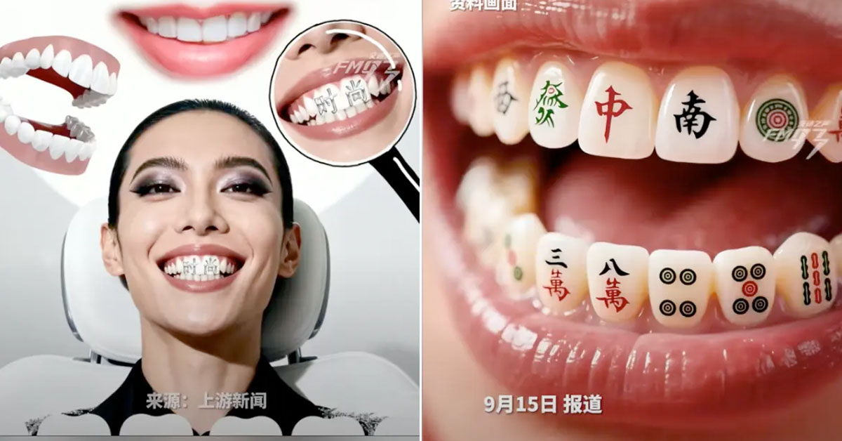 Instead of Tattoos, Teens in China Are Getting Custom Teeth