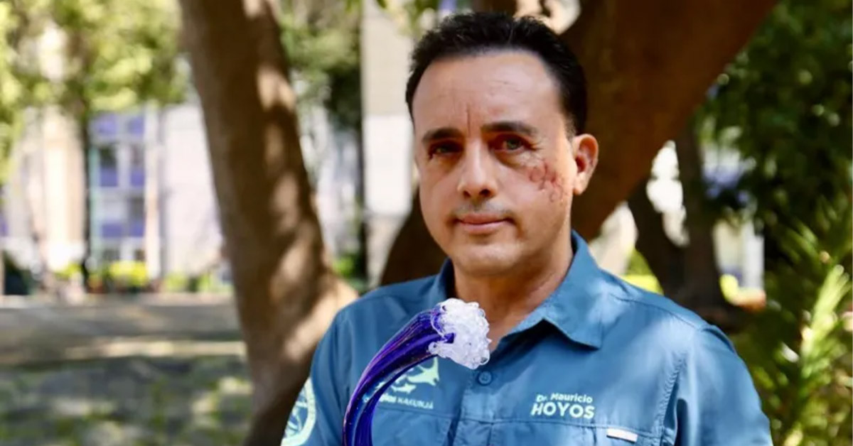 Man Wants to Be Reunited With the Shark That Nearly Bit His Head Off 