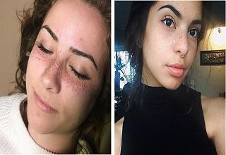 A new trend is emerging and it is called "freckling". Fortunately, the act is only semi-permanent and the small dots naturally fade over the months.