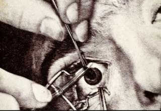 It used to be a whole lot worse, as this collection of shocking photos of ophthalmology from the 19th and 20th centuries show.
