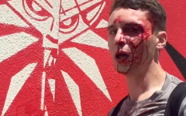 Bully Left Bloody After Picking Fight Over $10