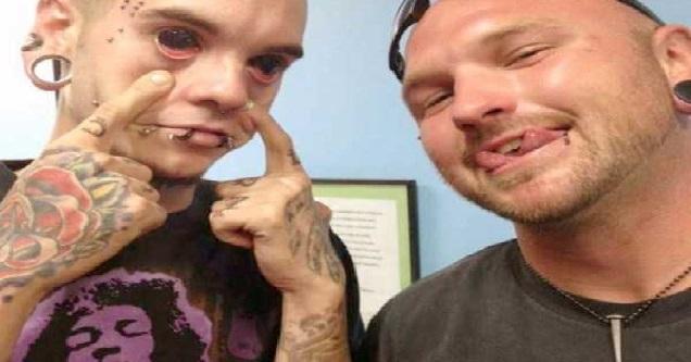 28 Bizarre Body Modifications That Will Make Your Cringe