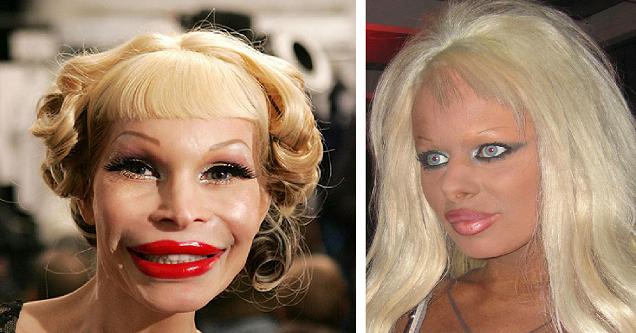 way too much plastic surgery