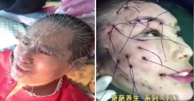 Questionable Medical Practices In Modern Day China