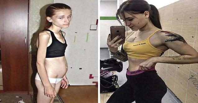 From Skeletal Anorexic To Bombshell Fitness Trainer
