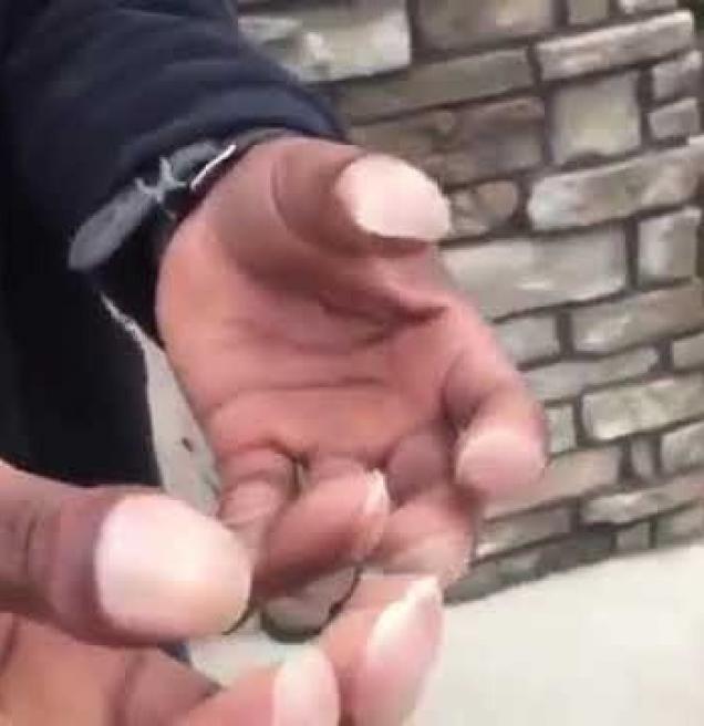 Man With Club Fingers Gets Incinerated By This Distasteful Roaster