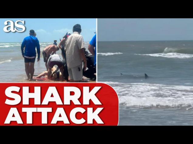 SHARK ATTACK in Texas DESTROYS woman's leg, leaves her hospitalized ...