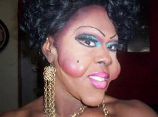 Creepy Plastic Surgery And Body Enhancement Pictures