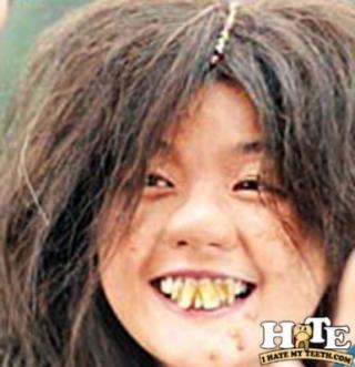 Gallery Of Horrible Teeth