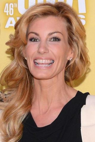 Celebrities Wearing Braces