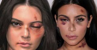 Kim K And Kendall Jenner Take Legal Action After Pictures Emerge Of Them Battered And Bruised