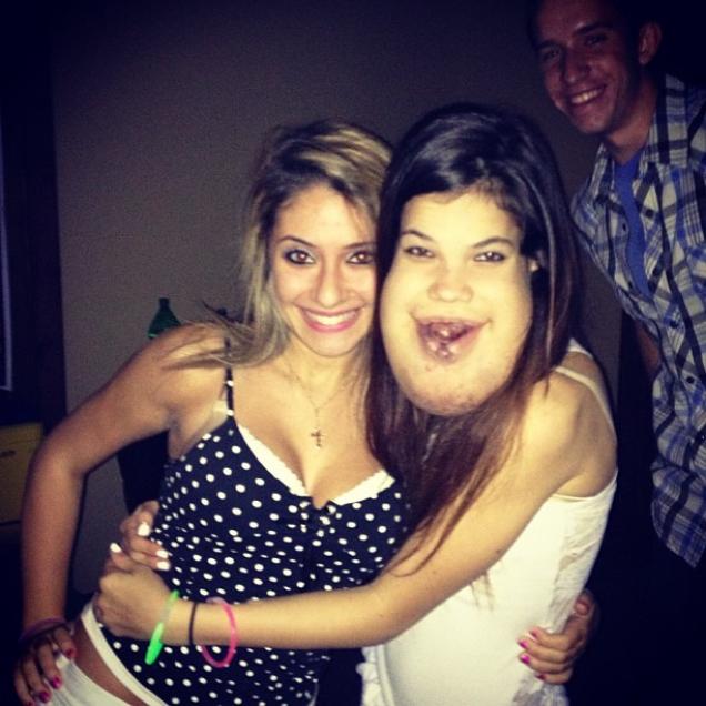 аномалия аксенфельда-ригера. не повезло родиться с красивой внешностью психолог. синдром аксенфельда-ригера мелани дикерсон. вероника зайцева сейчас. не повезло родиться с красивой внешностью психолог.