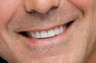 do you know your Celebrity Smiles