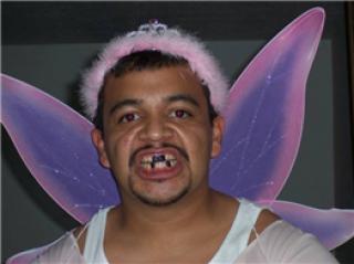 Gallery of Nasty Teeth