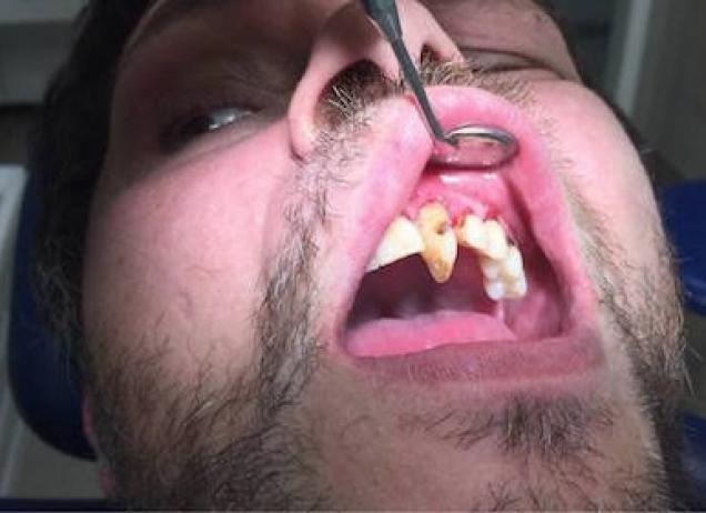 20 Images That Will Surely Make You Cringe